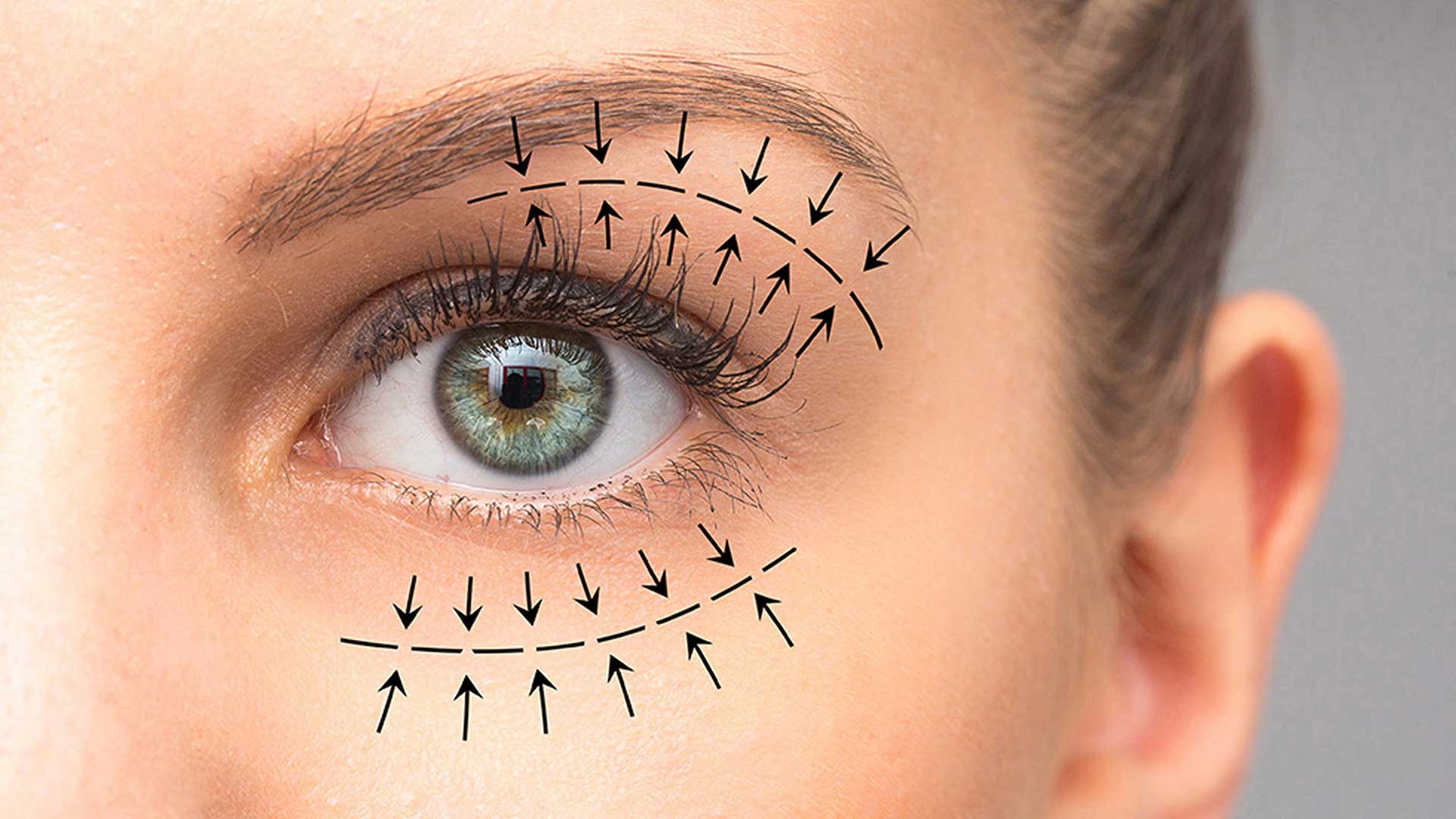 featured-image-blog-eye-treatments-1