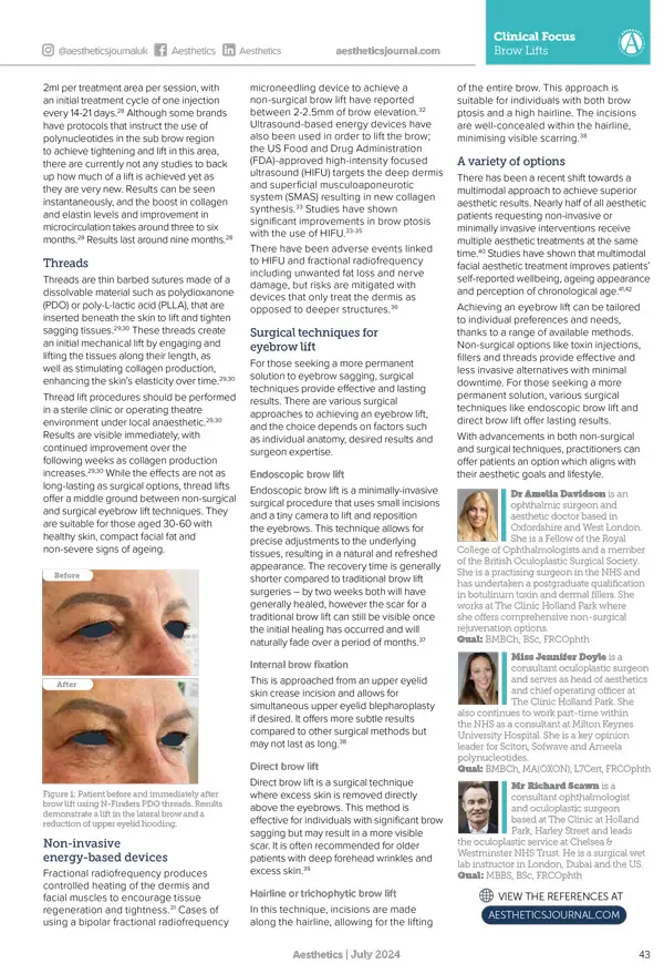 aesthetics-journal-july-2024-navigating-brow-lifts-2